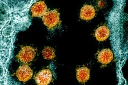 Según el informe, la inmunidad colectiva representará un final más definitivo de la pandemia (AP)