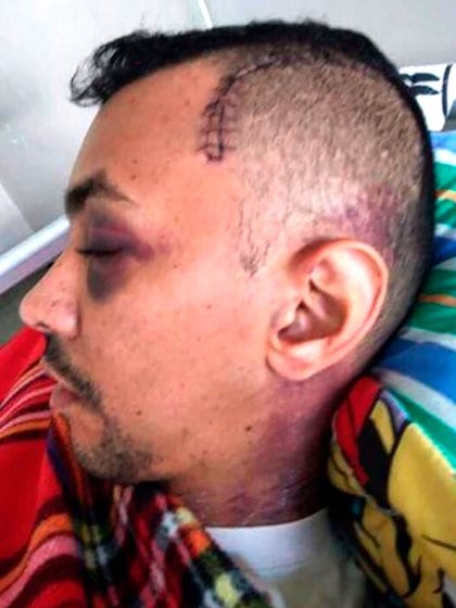 El primer teniente Luis Alejandro Mogollón Velásquez fue golpeado brutalmente