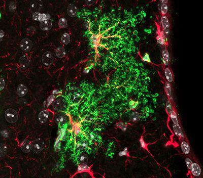 Imagen de las nuevas células "gorditas" del cerebro. Fueron encontradas en el cerebro del ratón. Se encuentran dormidas y podrían ser el blanco de algún tratamiento para esclerosis múltiple y otras enfermedades degenerativas del cerebro humano/ Ana Delgado y Fiona Doetsch