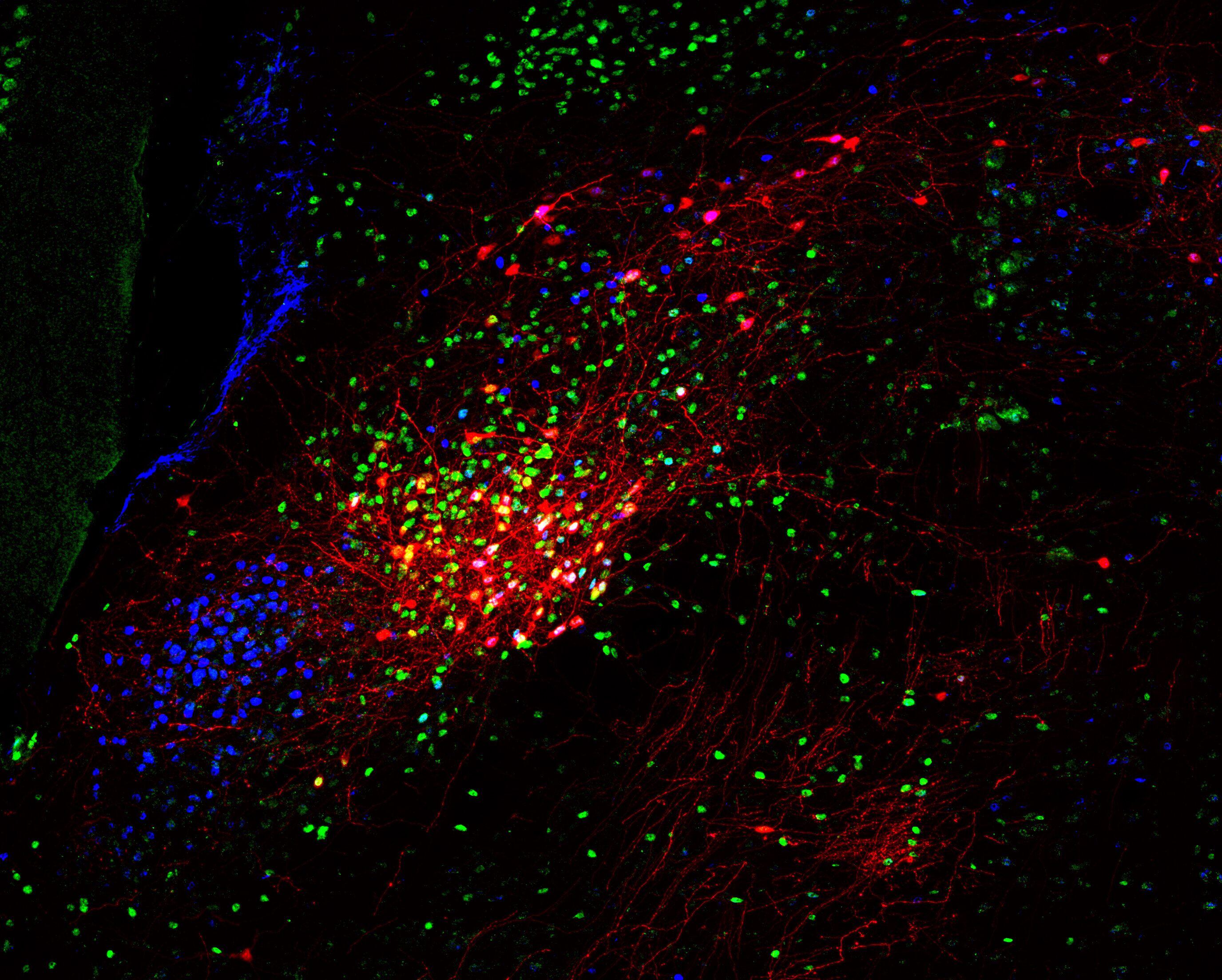 Las neuronas teñidas de rojo se proyectan por todo el cerebro para controlar la liberación de neurohormonas del estrés cuando se detecta una señal inflamatoria en la sangre. Las neuronas teñidas de verde son una subpoblación del núcleo parabraquial. El color azul muestra todos los núcleos de las células cerebrales (Instituto Pasteur / Ferdinand Jagot)