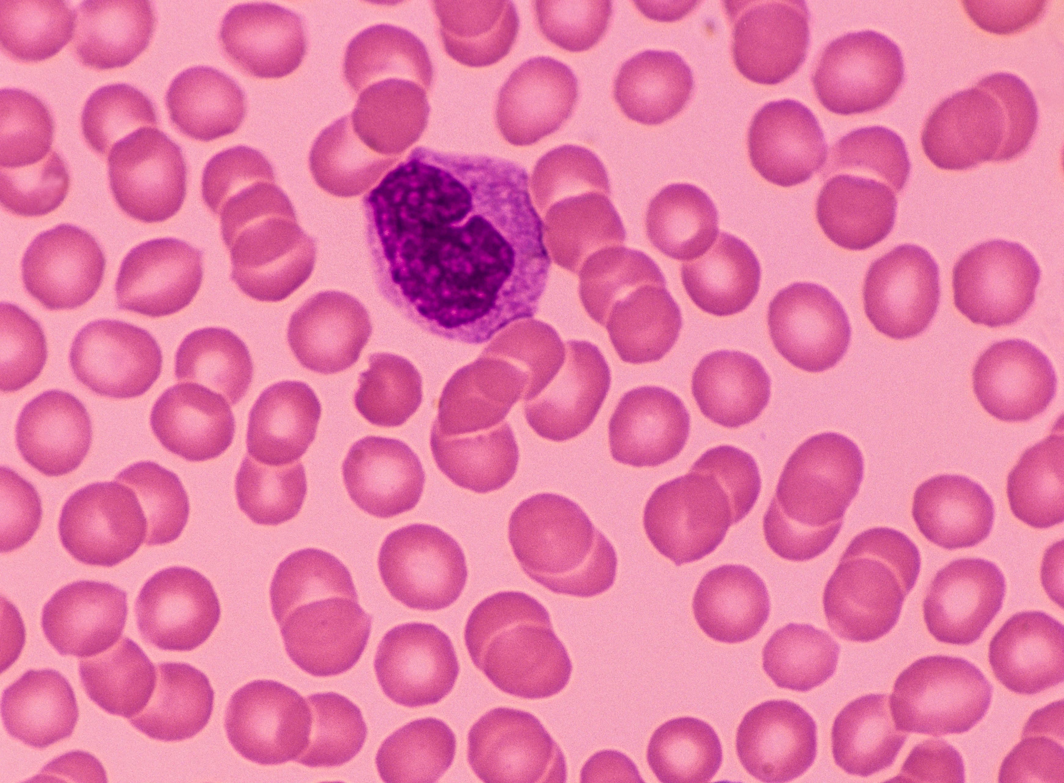 Según explicaron los NIH, "la médula ósea produce glóbulos rojos, siendo que las células madre en la médula ósea que dan origen a todas las células sanguíneas diferentes" / (Getty Images)