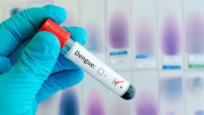 Los síntomas de coronavirus y dengue pueden llegar a confundirse debido a su similitud (Foto: Shutterstock)