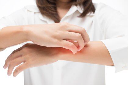 Prurito senil, eczema y dermatitis atópica: 3 problemas típicos en la piel (Shutterstock)