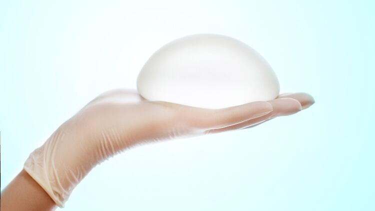 La Agencia Nacional de Productos Sanitarios de Francia prohibió el uso de varios modelos de prótesis mamarias (iStock)