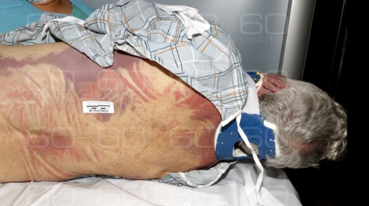 Jeffrey Epstein durante los exámenes previos a la autopsia (Gentileza 60 Minutes/CBS)