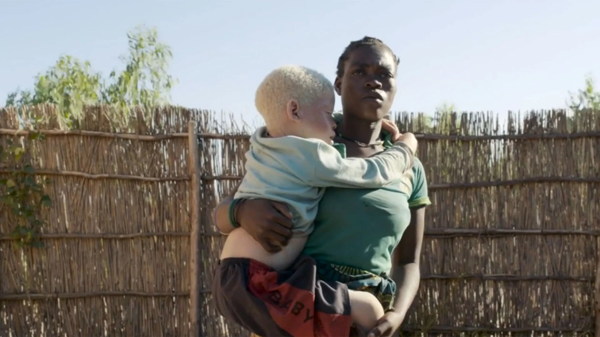Las mujeres albinas corren un doble riesgo: ser asesinadas y violadas. Se extendió la creencia que mantener relaciones sexuales con ellas cura el HIV/sida (Amnesty International)