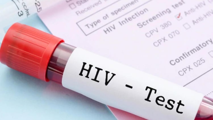 El 98% de las transmisiones de VIH se dan por la vía sexual