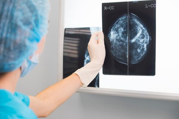 Existe hoy en día una protección contra rayos muy alta, por lo que la dosis de radiación que reciben las pacientes en el estudio es muy baja, y permite detectar lesiones de un pequeño tamaño que hacen que el cáncer de mama realmente sea curable (Getty Images)