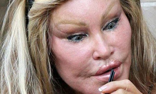 Jocelyn Wildenstein