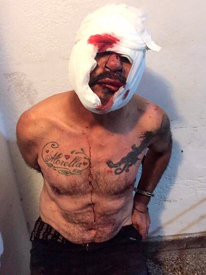 Horror en Los Hornos: encontraron a un hombre abusando de un nene de 3 años y los vecinos lo lincharon - Infobae