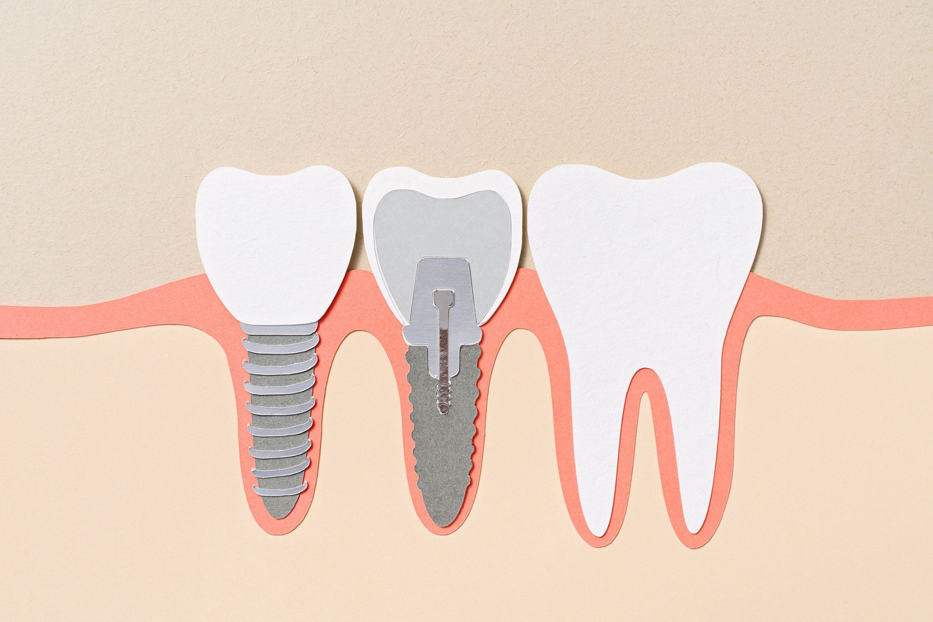 El fármaco se basa en un descubrimiento científico que activa los “brotes dentales” que la mayoría de las personas tienen en sus encías, pero que normalmente no se convierten en dientes y se atrofian. (GETTY)