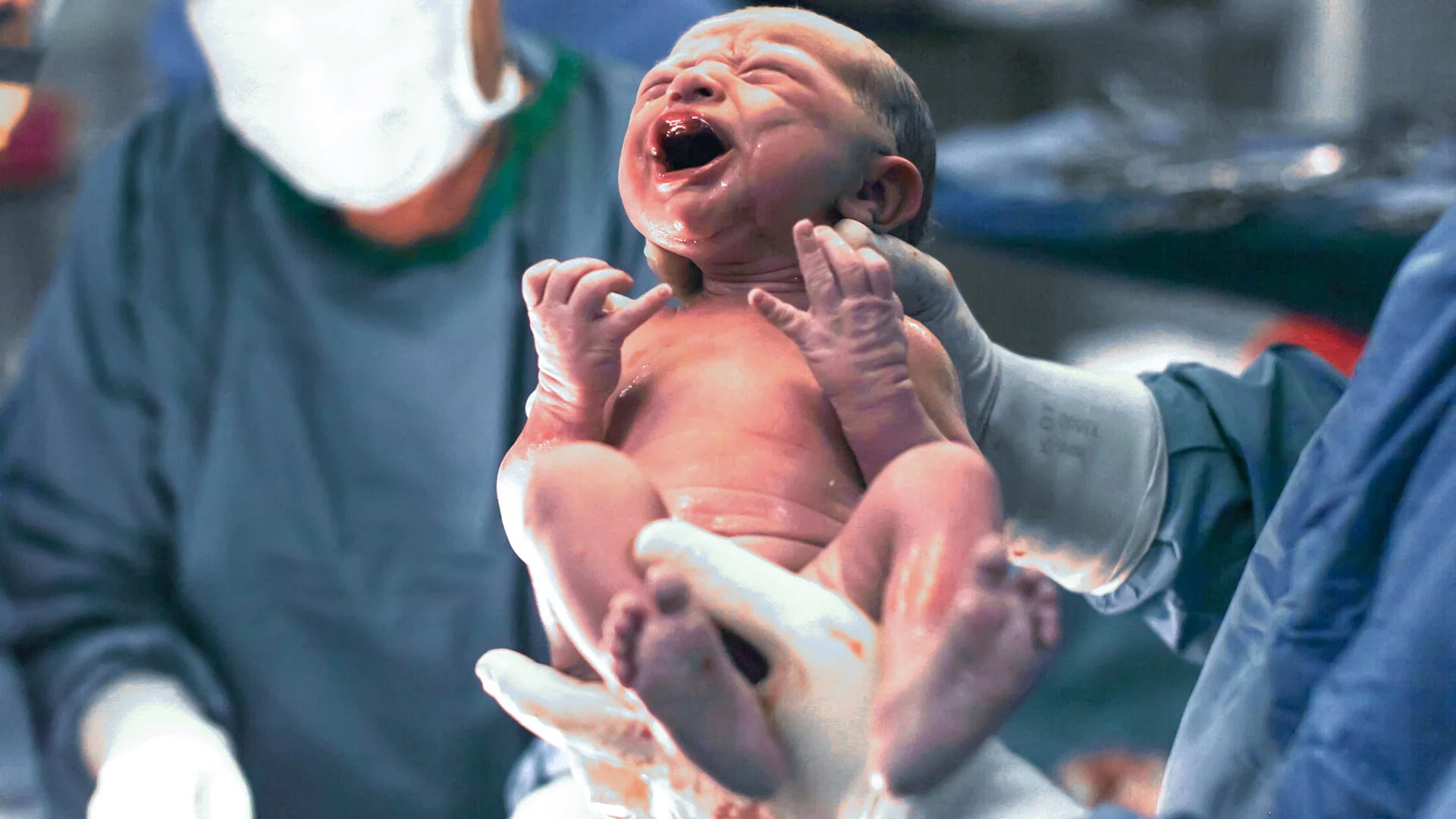 En qué consiste la técnica médica que puede beneficiar el desarrollo de los bebés nacidos por cesárea