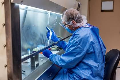 Un investigador de la Universidad de Pittsburgh trabaja en un candidato a la vacuna COVID-19, un parche del tamaño de la punta de un dedo con agujas microscópicas solubles, en Pittsburgh, Pensilvania (Reuters)