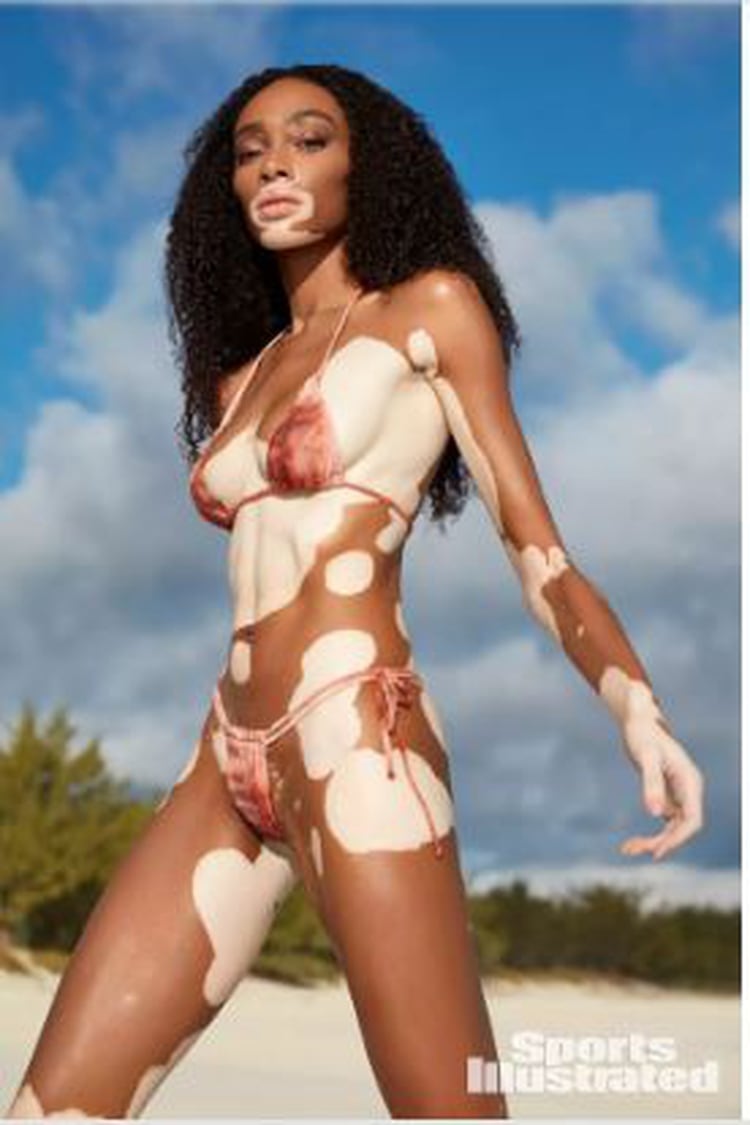 Winnie Harlow en Sports Illustrated (Foto: Sports Illustrated)