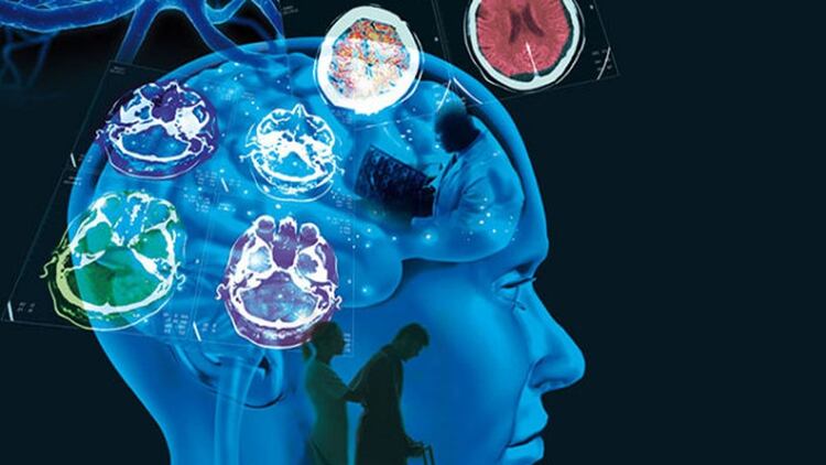 El método se dirige a una región específica del cerebro para controlar la actividad cerebral en casos de epilepsia, Parkinson y alteraciones tanto de la conciencia como del comportamiento
