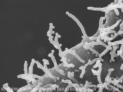 Los tentáculos se extienden desde una célula infectada por coronavirus a una sana (UC San Francisco)