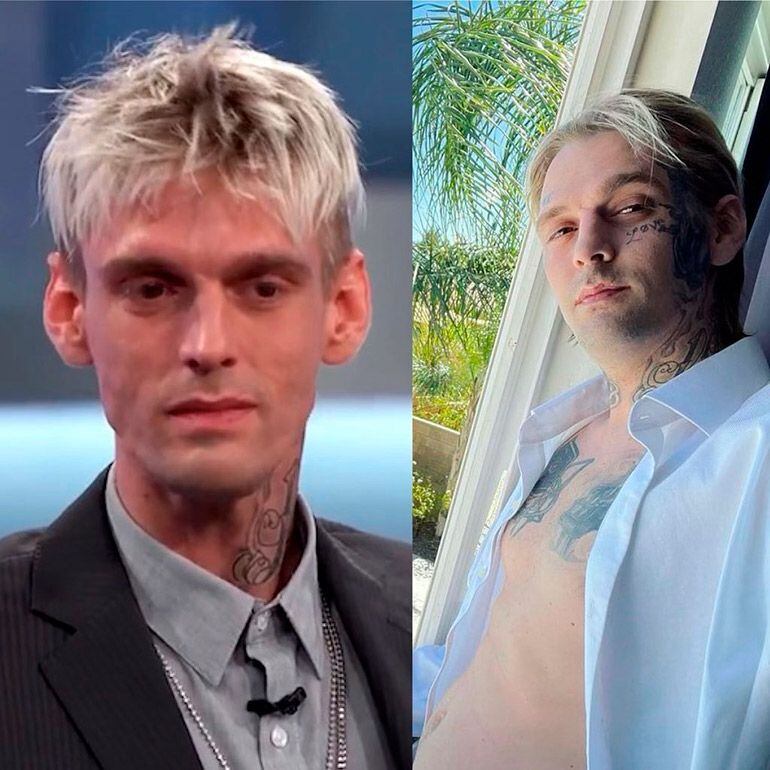 Aaron Carter, antes y después