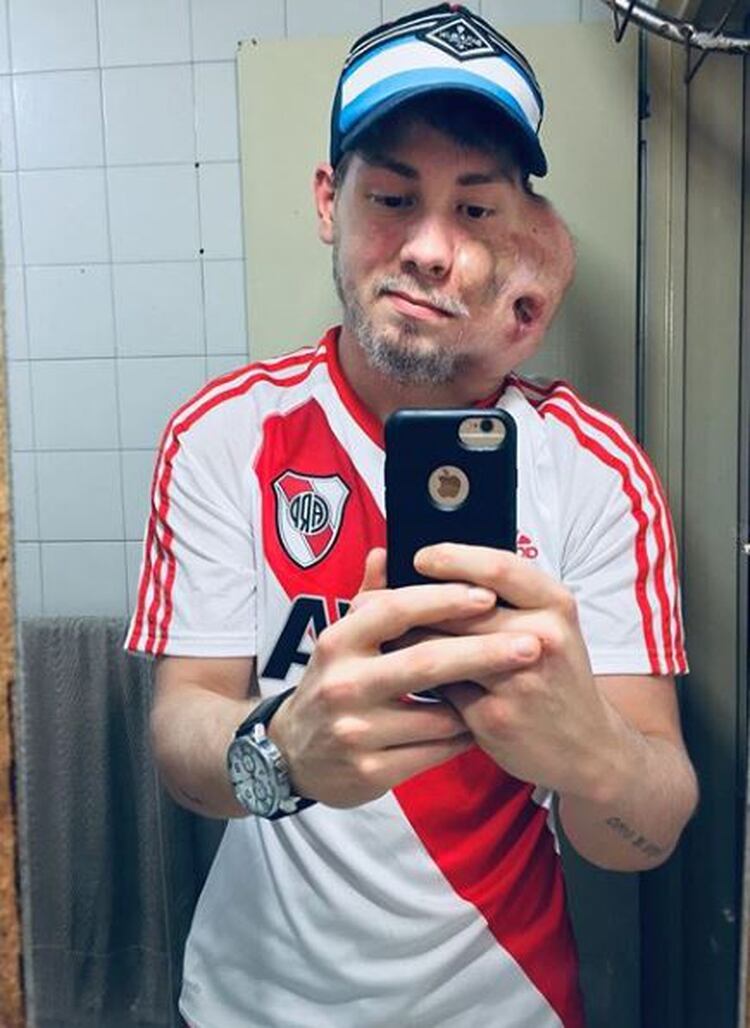 En un momento, D’Amico se cansó de los hospitales y decidió que no quería más tratamientos. Sin embargo, ahora vuelve a intentarlo.