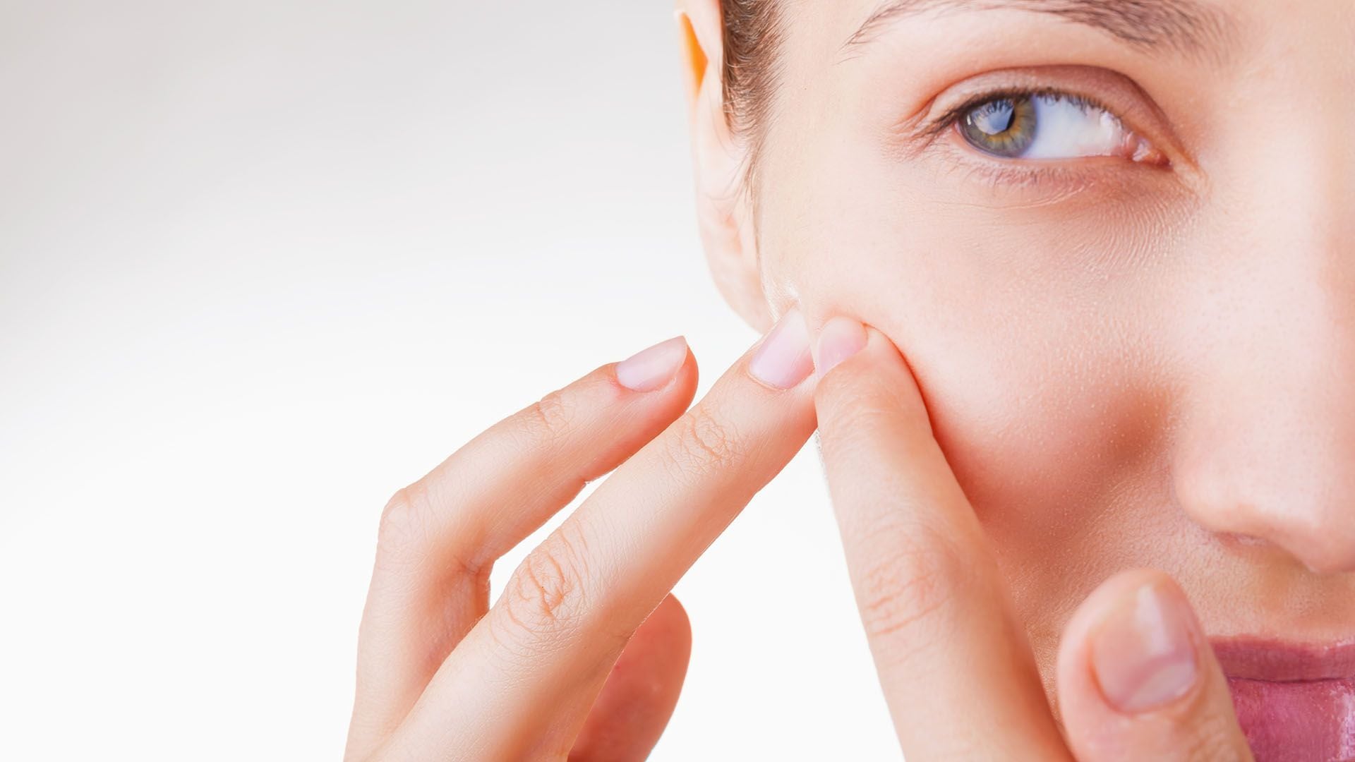 En un 12% de las mujeres y en un 3% de los hombres el acné puede continuar hasta aproximadamente los 45 años  (Getty)