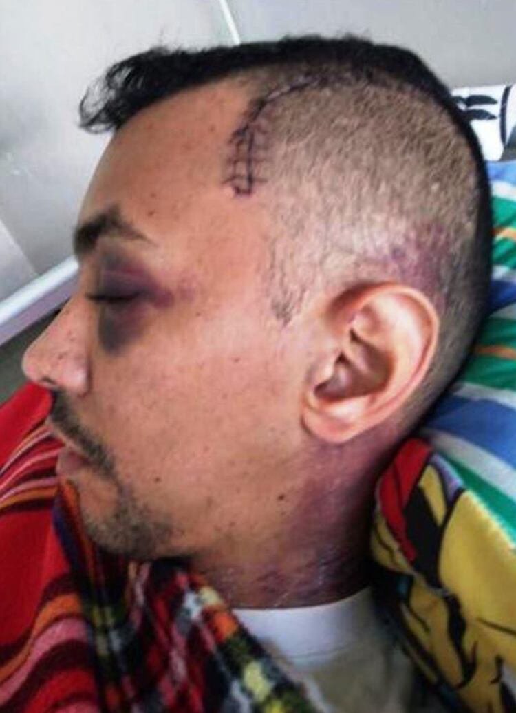 Luis Alejandro Mogollón Velásquez tras ser golpeado en la cabeza