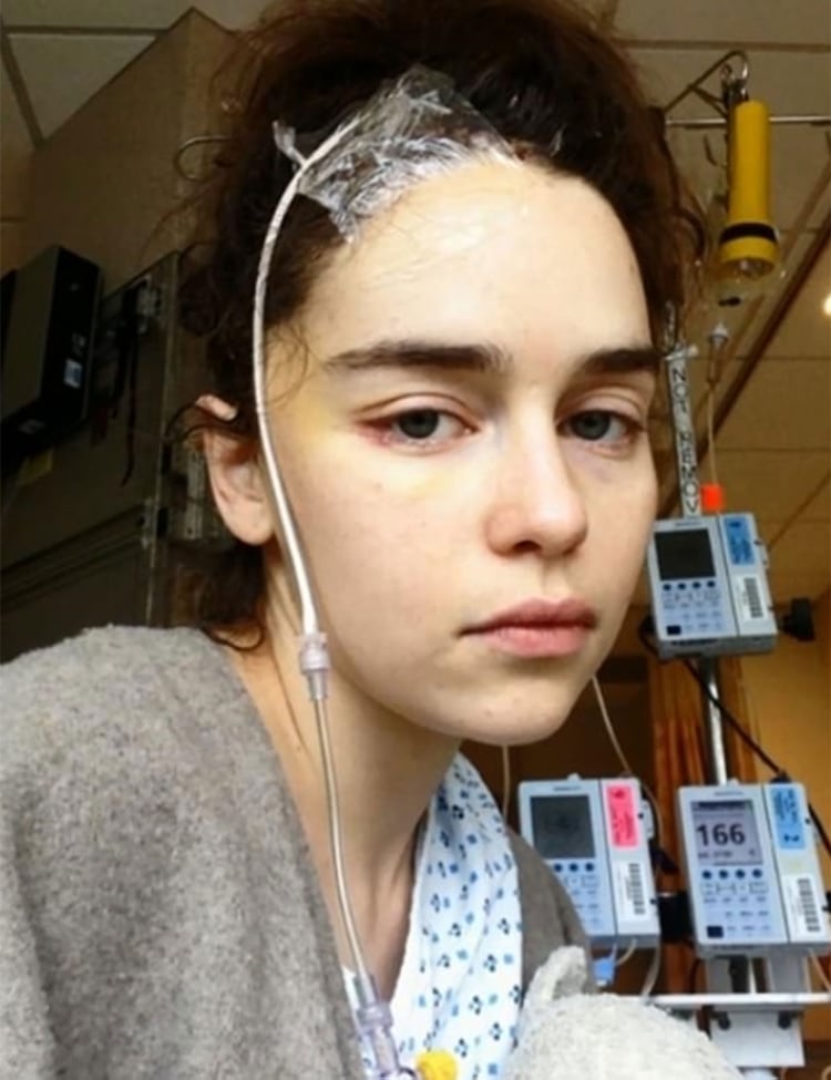 Emilia Clarke de âGame of Thronesâ mostrÃ³ imÃ¡genes Ã­ntimas tras superar un aneurisma cerebral