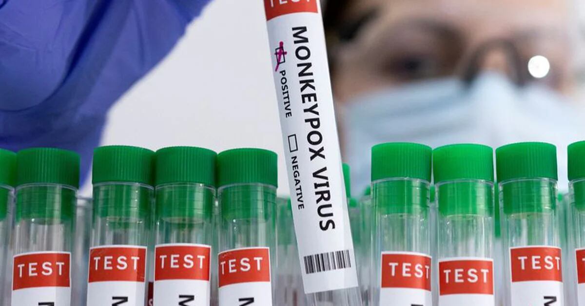 A OMS elevou os casos confirmados de varíola para 131: a maioria está na Espanha e em Portugal