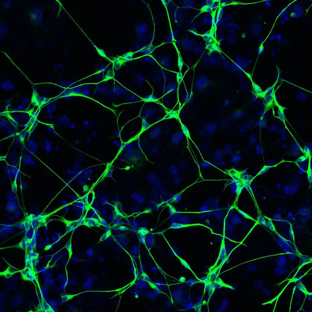 El modelo de ratón de la enfermedad de Alzheimer es más un modelo de una amiloidosis inducida genéticamente, más que un verdadero modelo de la enfermedad de Alzheimer (Salk Institute)