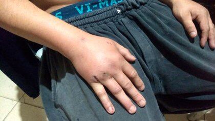 Las manos aún estaba heridas al momento de la detención