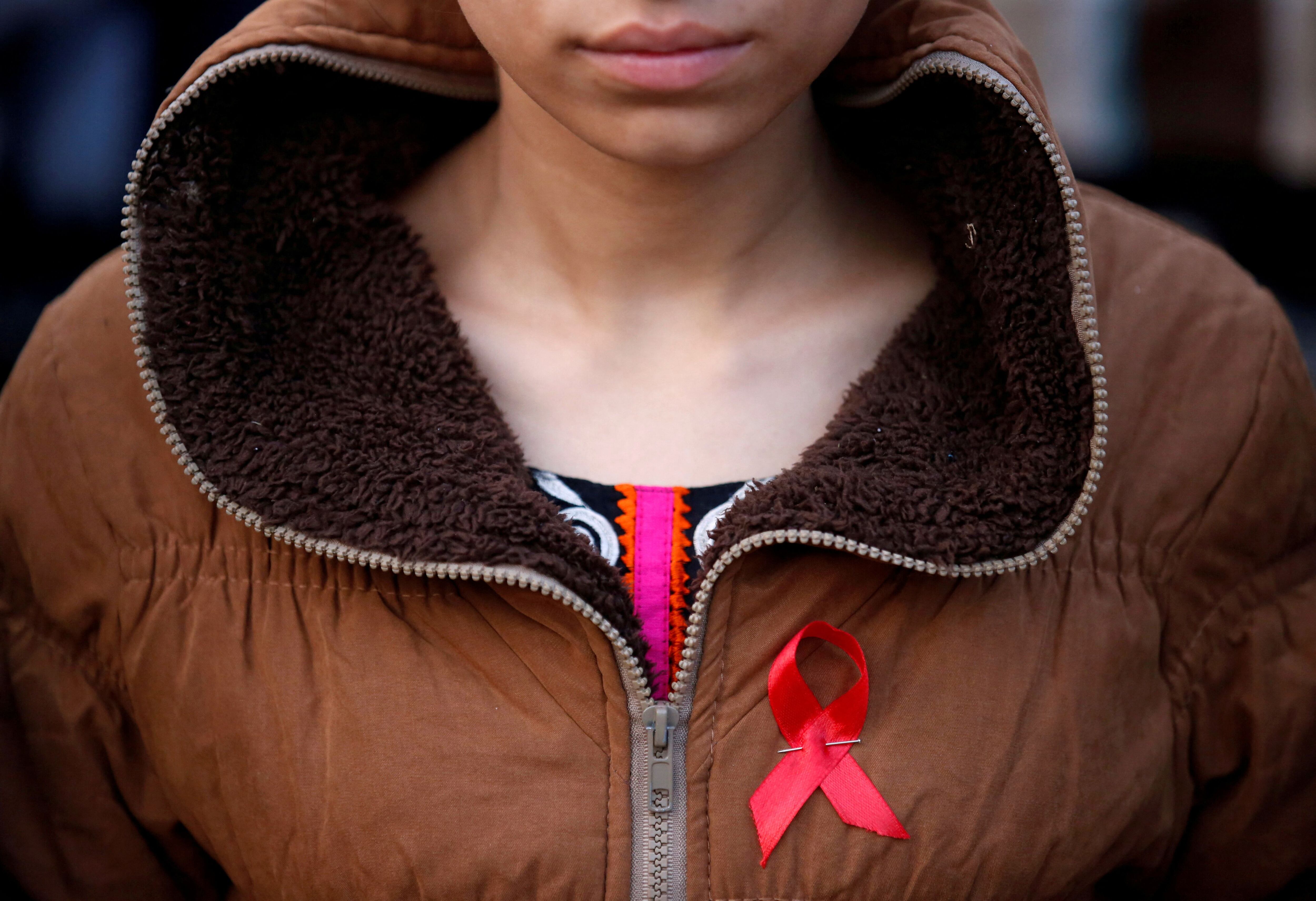 Según la Clínica Mayo, "el síndrome de inmunodeficiencia adquirida (sida) es una afección crónica que pone en riesgo la vida provocada por el virus de la inmunodeficiencia humana (VIH)" (REUTERS)
