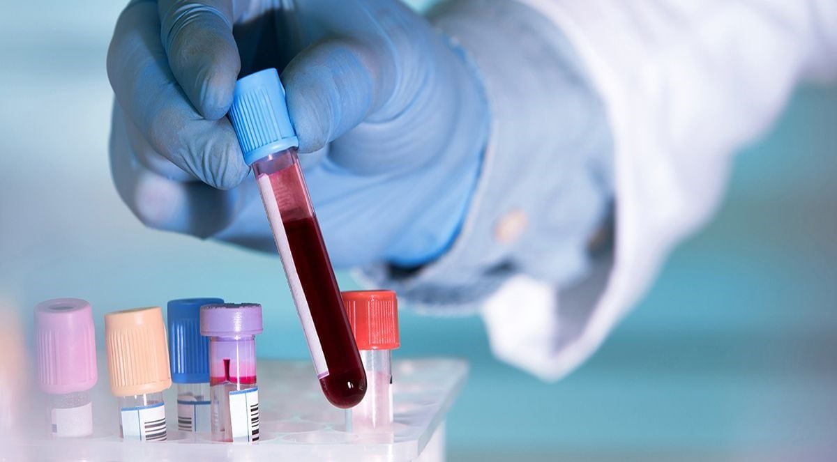 Un simple análisis basta para detectar positividad cáncer de sangre (BLUEBERRY DIAGNOSTICS)
