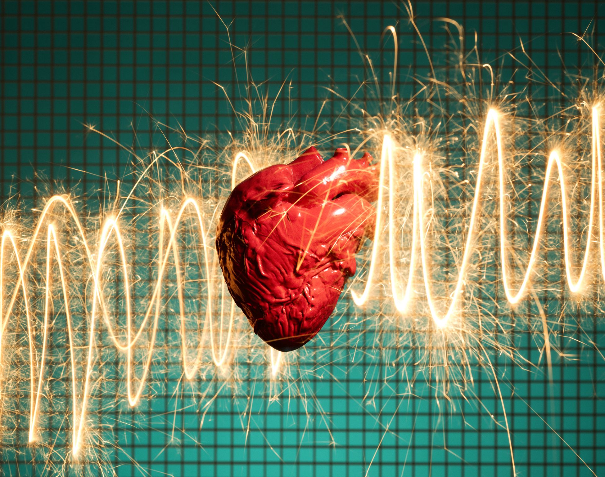 Estos son los síntomas del paro cardíaco (Getty Images).