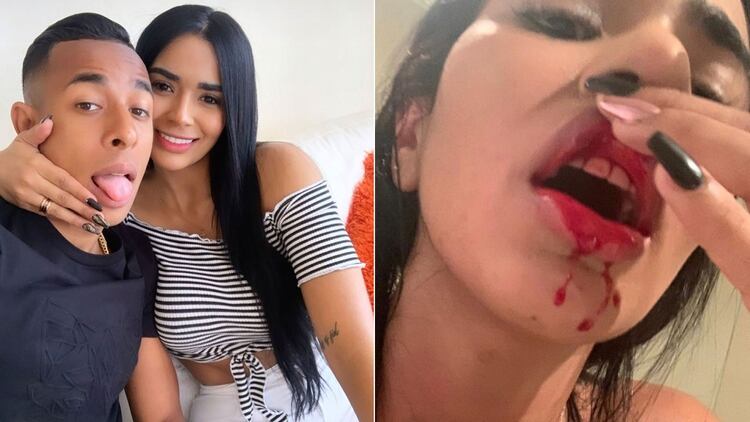 Daniela Cortés publicó fotos de las heridas provocadas por las agresiones de Sebastiá Villa