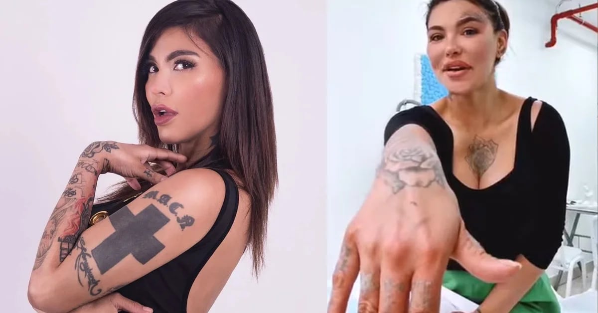 Angie Jibaja undergoes treatment to erase all the tattoos on her body