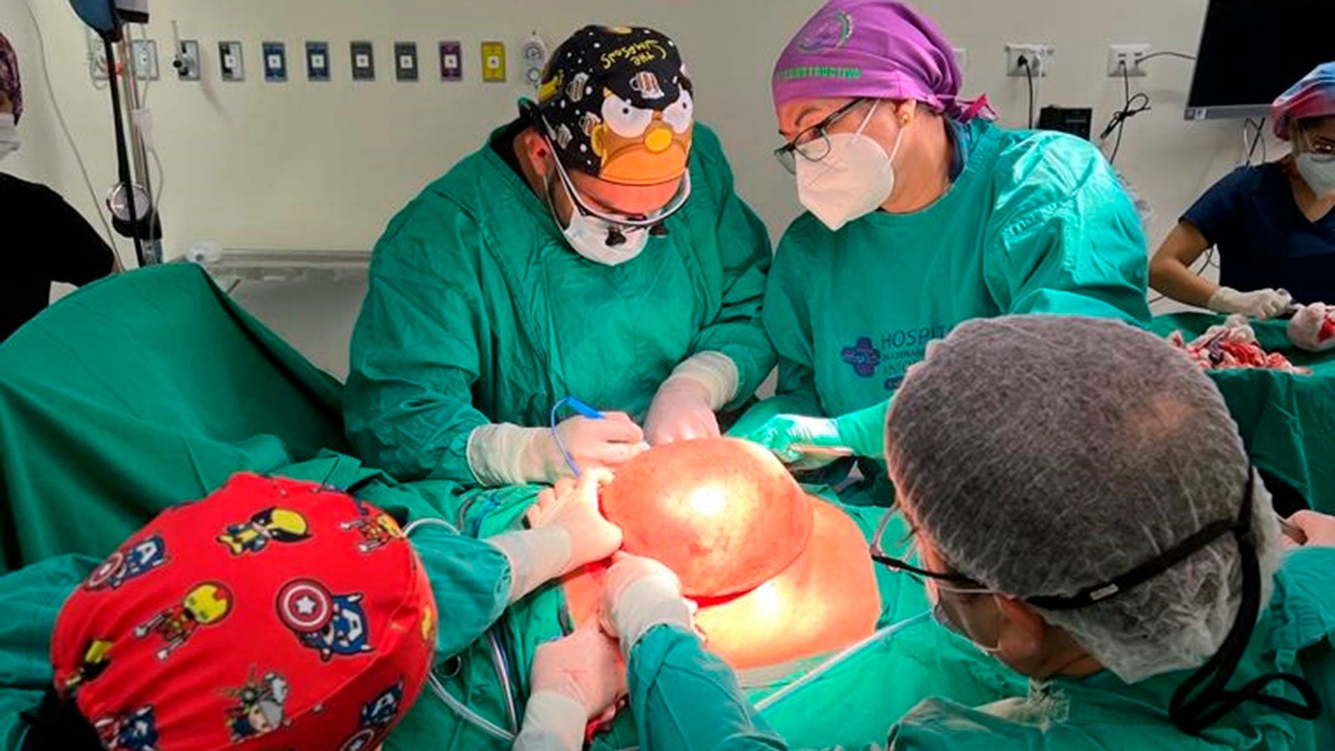 Más de 20 cirujanos y asistentes operaron durante 11 horas a un paciente en Chile para extirparle un tumor de 4,2 kilos