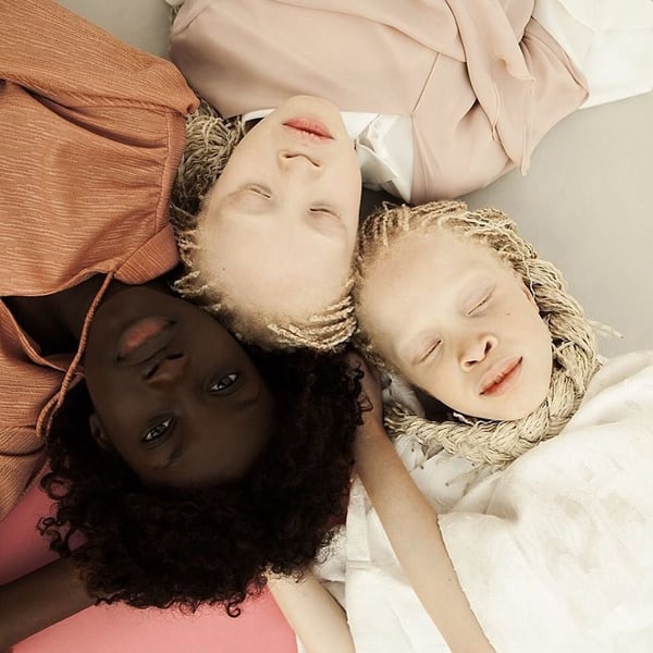 La piel negra de Sheila contrasta con la de sus hermanas gemelas y albinas, Mara y Lara. Podes ver sus trabajos en su Instagram @lara_mara_ sheila. En algunas fotos aparecen junto a su madre.