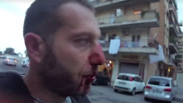 El periodista Daniele Piervincenzi después de la agresión (Rai)
