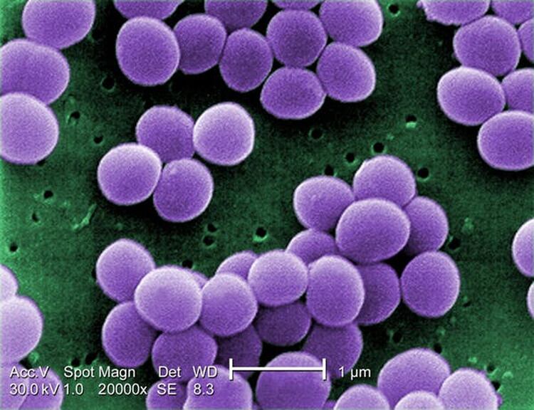 ‘Staphylococcus aureus’, una de las bacterias más comunes de nuestra piel