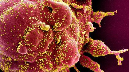 FILE PHOTO: Colorized scanning electron micrograph of an apoptotic cell (red) infected with SARS-COV-2 virus particles (yellow), also known as novel coronavirus, isolated from a patient sample. Image captured at the NIAID Integrated Research Facility (IRF) in Fort Detrick, Maryland. National Institute of Allergy and Infectious Diseases, NIH/Handout via REUTERS. THIS IMAGE HAS BEEN SUPPLIED BY A THIRD PARTY. MANDATORY CREDIT/File Photo