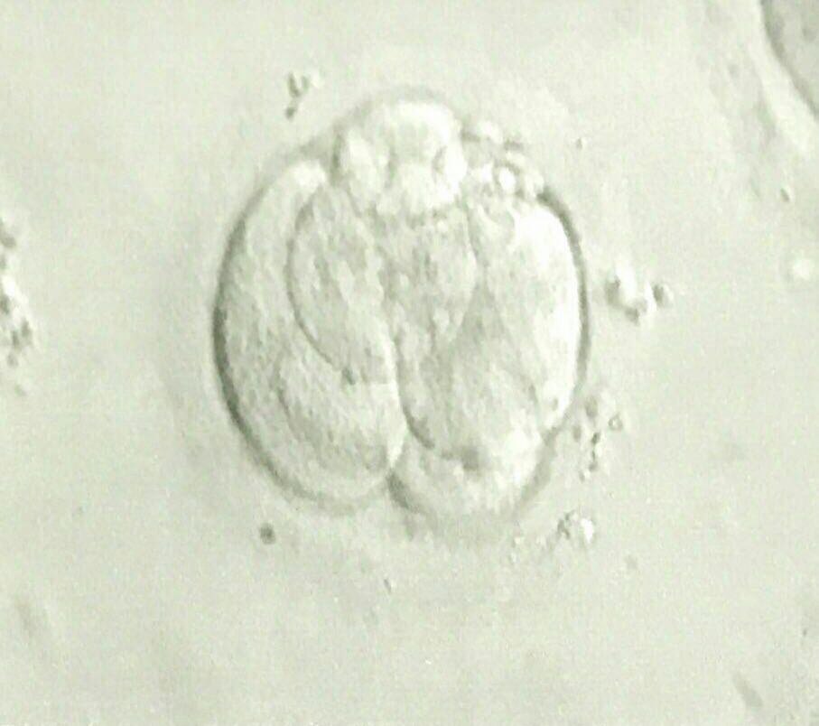 Una imagen del embrión de dos días que luego sería Victoria. Silvana se hizo el tratamiento de fertilización in vitro en el IFER y gracias a la Ley de Fertilidad.