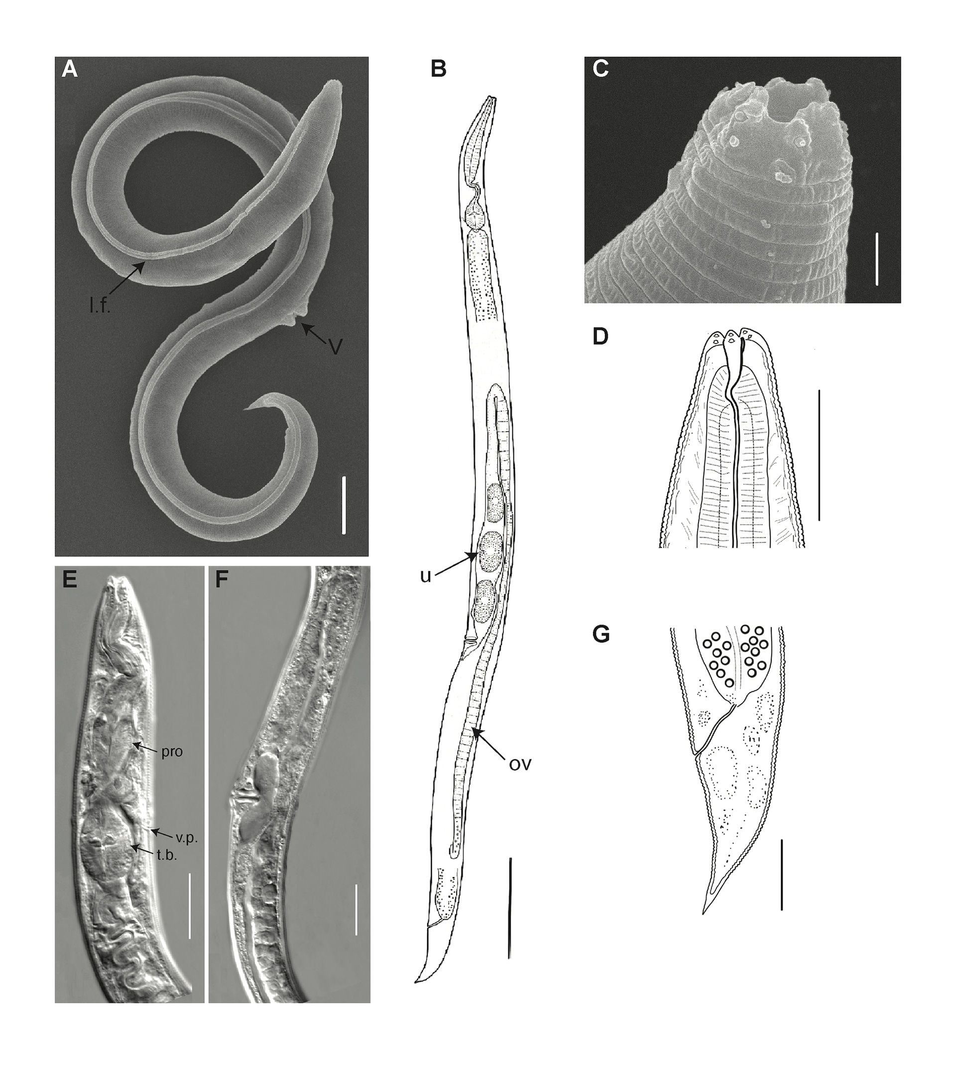 Imágenes electrónicas de barrido (A, C), fotografías de microscopía óptica (E, F) y presentaciones gráficas (B, D, G) del holotipo: A, B) cuerpo entero, C, D) extremos anteriores, E) cuerpo anterior, F) región del cuerpo perivulvar, G) cola. (Foto de PLoS Genetics)