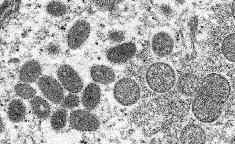 El actor contó que la infección con el virus de la viruela símica le generó 25 manchas en el cuerpo (foto: Cynthia S. Goldsmith, Russell Regnery/CDC/via REUTERS)