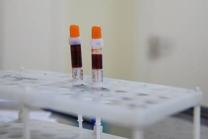 Muestras de sangre de pacientes con coronavirus REUTERS/Maxim Shemetov