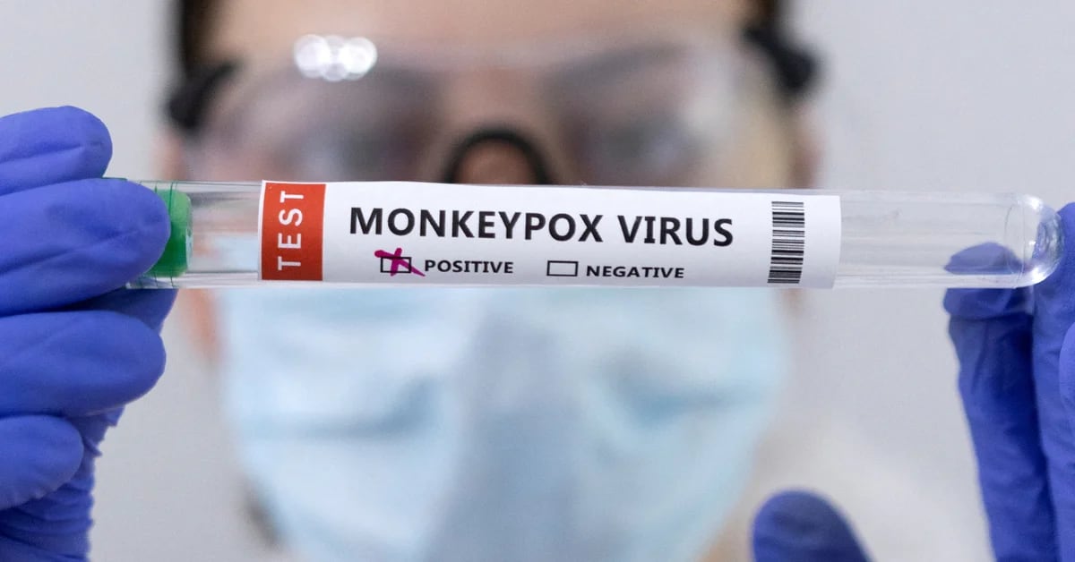 Monkeypox: 5 chiavi di trasmissione fornite da studi scientifici condotti sui pazienti
