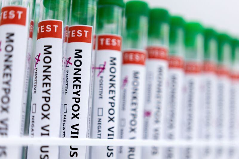 FOTO DE ARCHIVO. Imagen de ilustración de tubos de ensayo etiquetados como "Virus de la viruela del mono positivo y negativo". 23 de mayo de 2022. REUTERS/Dado Ruvic