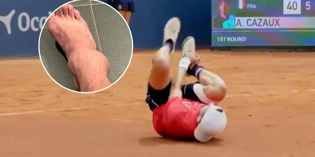 La terrible lesión de un tenista que dio la vuelta al mundo: la foto de su tobillo que hizo recordar a Maradona en Italia 90