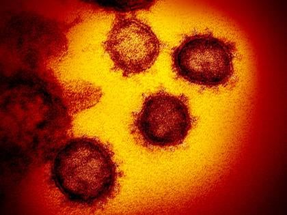 La imagen del microscopio muestra al SARS-CoV-2, el virus que causa COVID-19, aislado de una muestra tomada a un paciente (NIAID-RML/Handout via REUTERS)