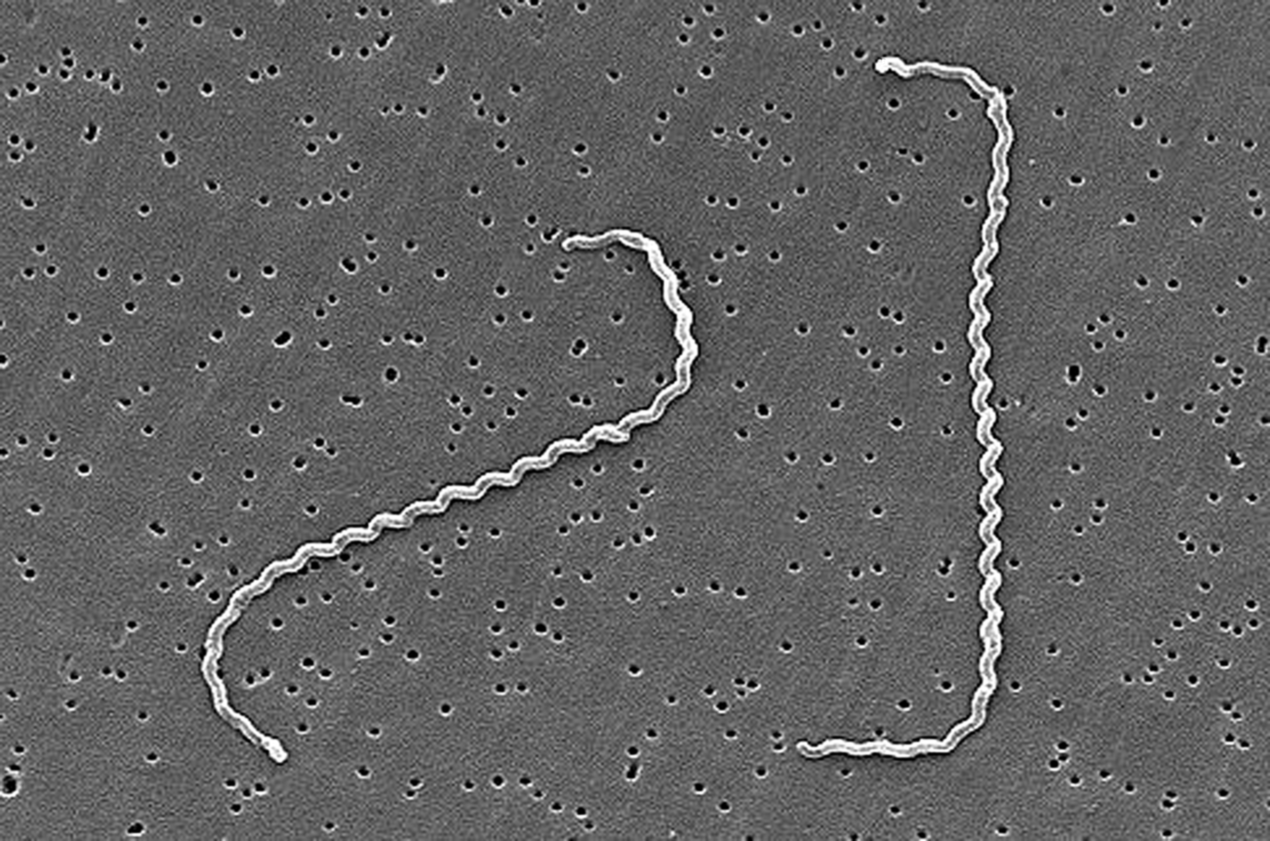 This scanning electron microscopic (SEM) image reveals some of the ultrastructural features exhibited by two, spiral-shaped, Leptospira interrogans, strain-RGA bacteria. These two spirochetes were bound to a 0.2 µm filter. Strain RGA was isolated in 1915, by Uhlenhuth and Fromme, from the blood of a soldier in Belgium. High Resolution:	Click here for hi-resolution image (10.87 MB) Content Providers(s):	CDC/ Rob Weyant, PhD, MS