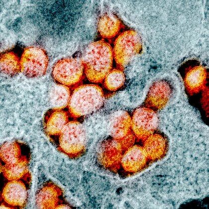El nuevo coronavirus ha mutado desde su aparición en enero - (IRF)/Handout via REUTERS. 