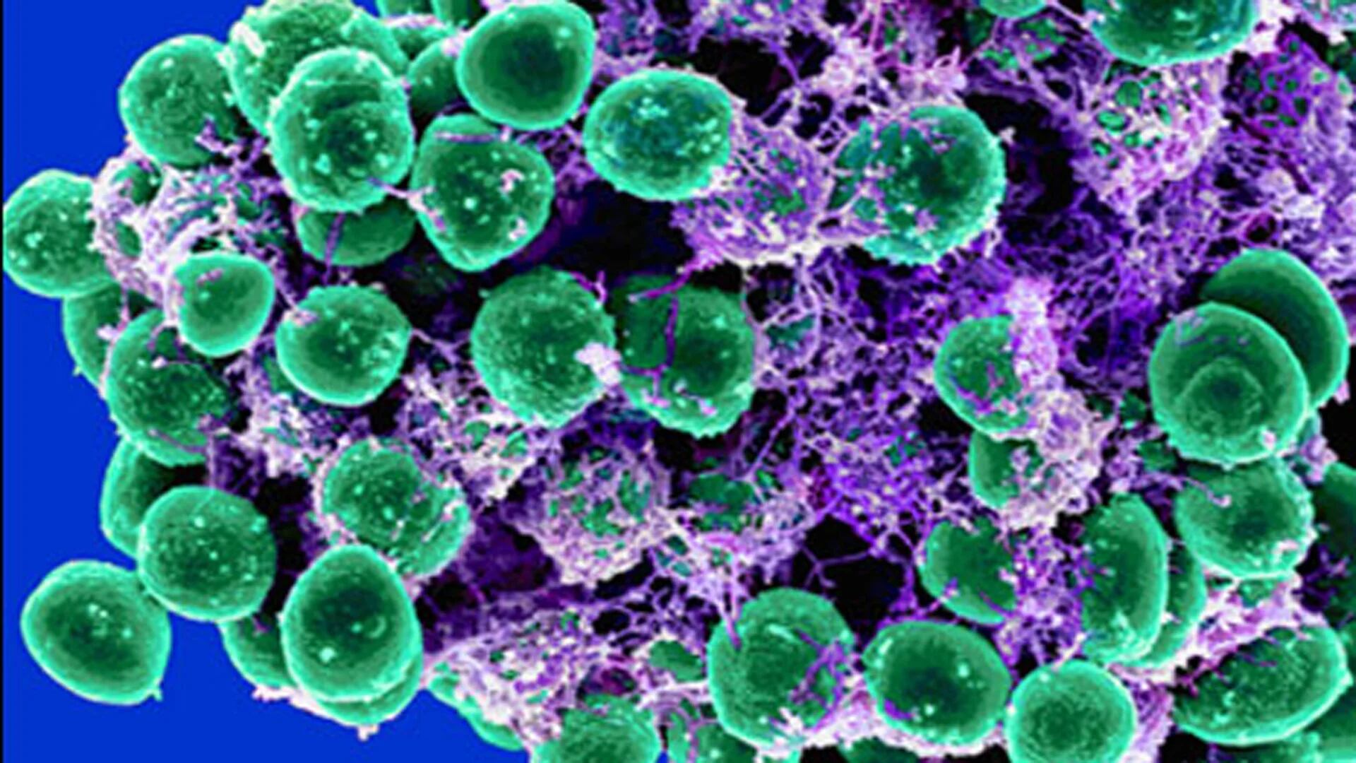 Hay 33 patógenos especialmente resistentes a los antimicrobianos