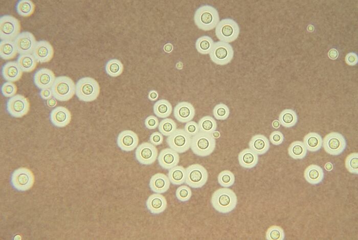 CAPTION This photomicrograph depicts Cryptococcus neoformans a fungal pathogen that has been causing an increasing number of life-threatening infections. People with AIDS, and those using immunosuppressive drugs are most vulnerable.  CREDIT U.S. Centers for Disease Control